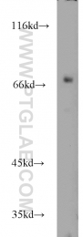 22138-1-AP - Tyrosine-protein kinase RYK