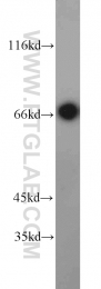 22138-1-AP - Tyrosine-protein kinase RYK