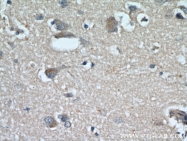 19765-1-AP - Ryanodine receptor 2 / RYR2