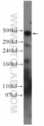 19765-1-AP - Ryanodine receptor 2 / RYR2
