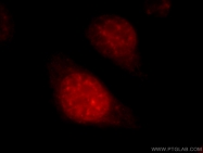 22675-1-AP - SART1