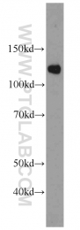 22675-1-AP - SART1