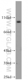 12751-1-AP - EXOC2 / SEC5