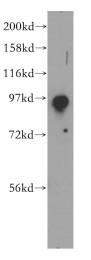 12751-1-AP - EXOC2 / SEC5
