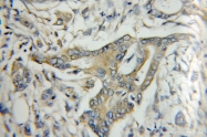 11430-2-AP - Kallistatin / SERPINA4