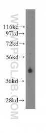 11430-2-AP - Kallistatin / SERPINA4