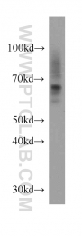 20507-1-AP - NRAMP2 / SLC11A2
