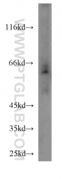 20507-1-AP - NRAMP2 / SLC11A2