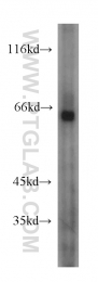 20507-1-AP - NRAMP2 / SLC11A2