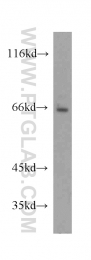20507-1-AP - NRAMP2 / SLC11A2