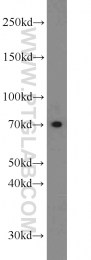 20507-1-AP - NRAMP2 / SLC11A2