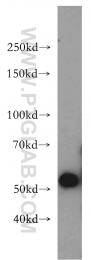 20676-1-AP - SLC16A2
