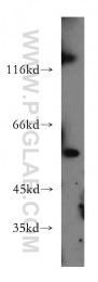 20676-1-AP - SLC16A2