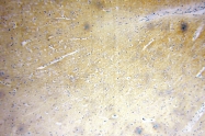 17363-1-AP - Zinc transporter 3 / SLC30A3