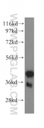 17363-1-AP - Zinc transporter 3 / SLC30A3