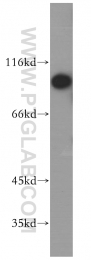 14236-1-AP - Zinc transporter ZIP6 / SLC39A6
