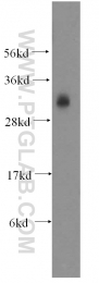 13315-1-AP - GINS4 / SLD5