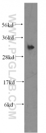 13315-1-AP - GINS4 / SLD5
