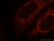 10498-1-AP - Beta-Synuclein / SCNB