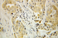 10498-1-AP - Beta-Synuclein / SCNB