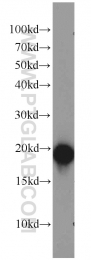 10498-1-AP - Beta-Synuclein / SCNB