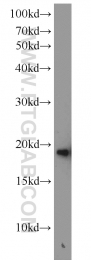 10498-1-AP - Beta-Synuclein / SCNB