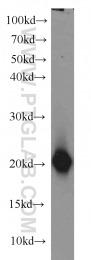 10498-1-AP - Beta-Synuclein / SCNB