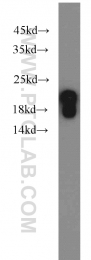 10498-1-AP - Beta-Synuclein / SCNB