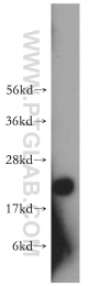 10234-2-AP - Transgelin-2 (TAGLN2)
