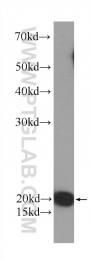 60044-1-Ig - Transgelin-2 (TAGLN2)