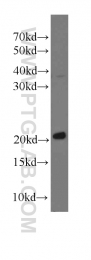 60044-1-Ig - Transgelin-2 (TAGLN2)