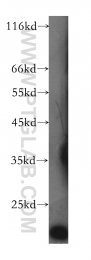 60044-1-Ig - Transgelin-2 (TAGLN2)