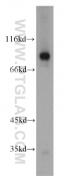 12912-3-AP - Transglutaminase-1 (TGM1)