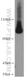 12912-3-AP - Transglutaminase-1 (TGM1)
