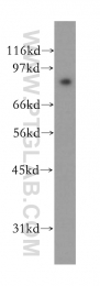12912-3-AP - Transglutaminase-1 (TGM1)