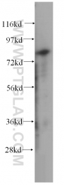 15100-1-AP - Transglutaminase-2 (TGM2)