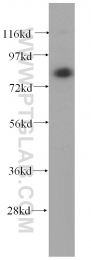 15100-1-AP - Transglutaminase-2 (TGM2)
