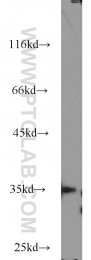 15316-1-AP - WDR58 / THOC6
