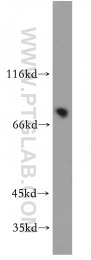 21099-1-AP - TMCC1