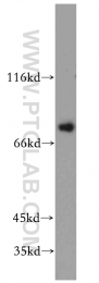 21099-1-AP - TMCC1