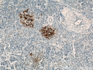 15199-1-AP - TMED10 / TMP21