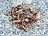 15199-1-AP - TMED10 / TMP21