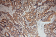 15199-1-AP - TMED10 / TMP21