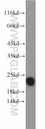 15199-1-AP - TMED10 / TMP21