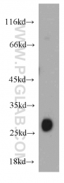 21620-1-AP - TMED9