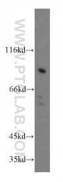 19851-1-AP - TMEM173 / STING