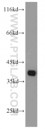 19851-1-AP - TMEM173 / STING