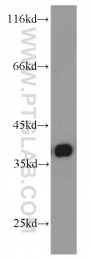 19851-1-AP - TMEM173 / STING