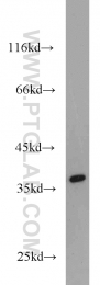19851-1-AP - TMEM173 / STING