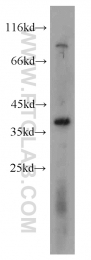 19851-1-AP - TMEM173 / STING